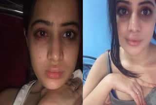 Uorfi Javed ने शेयर की दर्दनाक लिप फिलर्स की जर्नी, बताया 'बोटोक्स के बाद कैसी होती है हालत'