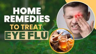 Eye Flu Prevention: Home Remedies That Can Prevent Eye Flu - Watch Video