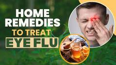 Eye Flu Prevention: Home Remedies That Can Prevent Eye Flu - Watch Video
