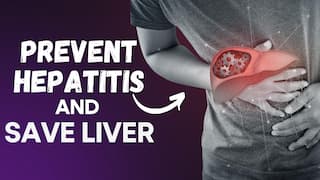 World Hepatitis Day 2023: Know Everything About Hepatitis and It's Prevention - Watch Video