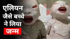 Alien Child Birth: महिला ने एलियन जैसे बच्चे को दिया जन्म, डॉक्टर्स को भी लगा झटका| Watch Video