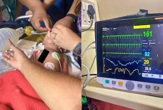 दो वर्षीय बच्ची ने हवा में सांस लेना कर दिया बंद, AIIMS  के डॉक्टरों ने  दिया जीवनदान