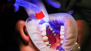 Explained: What Is National Dental Commission Bill And How It Will Elevate Dental Education, Healthcare Standards In India