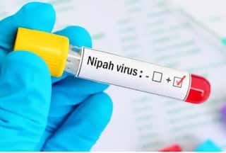 Nipah Virus Outbreak in Kerala: 3 Risk Factors That Increase Severe Infection