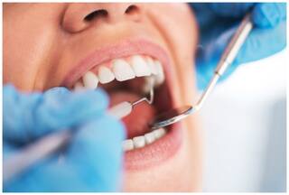 रिसर्च में सामने आई चौंकाने वाली बात, दांतों की सफाई से कम होता है सिर और गर्दन के कैंसर का खतरा