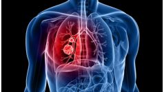 World Lung Day 2023: फेफड़े की गंभीर बीमारी है COPD,जानिए इसके लक्षण, कारण और बचाव के उपाय