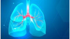 World Lung Day 2023: हल्के कोरोना संक्रमण वाले 25% मरीज एक साल बाद भी फेफड़ों की बीमारी से पीड़ित