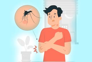 Dengue Fever: 8 Most Common Questions That Are Asked About The Disease, And Their Answers