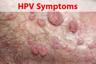 जानें HPV क्या होता है? इसके लक्षण और गुप्तांगों को कैसे प्रभावित करता है?