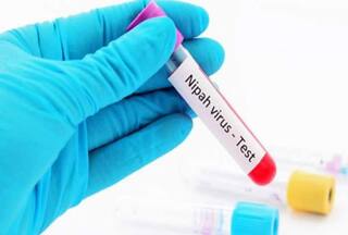 Nipah Virus का होगा खात्मा! भारत ने ऑस्ट्रेलिया से मांगी एंटीबॉडी डोज, जानिए कितनी कारगर