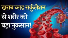 Bad Blood Circulation: खराब ब्लड सर्कुलेशन से शरीर में हो सकती हैं बड़ी दिक्कतें, दिखते हैं ये घातक लक्षण - WATCH Video