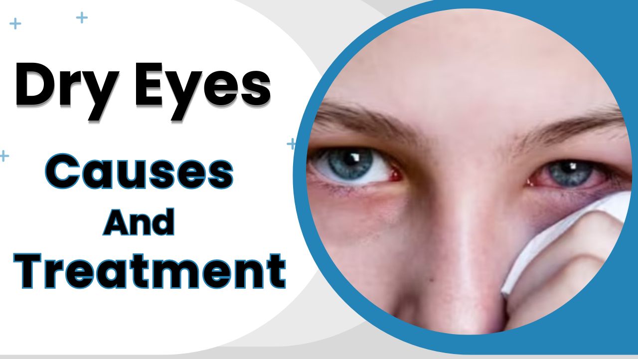 Dry Eyes: Causes, Symptoms, and Treatment