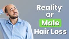 Hair Loss: Unveiling Male Hair Loss Trends in India | Prevention | Causes
