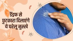 Home Remedies for Dandruff: घर पर रूसी का इलाज कैसे करें, अपनाएं ये नुस्खे