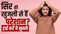 Home Remedies For Itchy Scalp: सिर खुजाते हो गए हैं परेशान, अपनाएं ये घरेलू नुस्खे