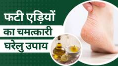Cracked Heels Remedies: फटी एड़ियों से छुटकारा दिलाएंगे ये घरेलू नुस्खे