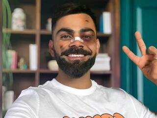 क्या विराट कोहली के साथ हुआ क्या हादसा, चेहरे पर चोट, नाक पर पट्टी, इस तस्वीर का राज क्या है