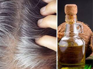 Black hair remedy: सफेद बालों को काला बनाने के लिए रोज नाभि में लगाएं ये 2 तेल, दादी-नानी के जमाने से कारगर है