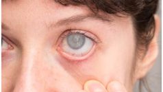 कैसी होती है आंखों की गंभीर बीमारी मैक्यूलर एडिमा? जानें इसके लक्षण और बचाव के उपाय