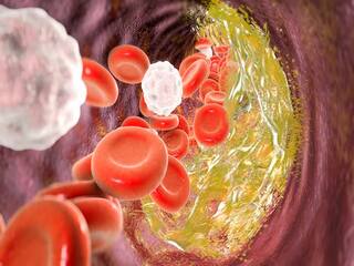 Green Tea For High Cholesterol: बेड कोलेस्ट्रॉल को शरीर से बाहर निकालती है ग्रीन टी, 7 फायदे जानिए