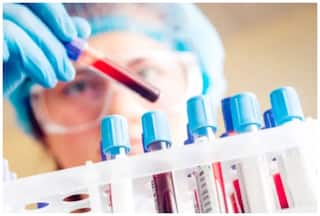 सीएआर-टी सेल थेरेपी जड़ से नष्ट करती है कैंसर कोशिकाएं, डॉक्टर से समझें कैसे करती है काम