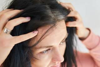 Tired of Dandruff? 5 Dietary Habits To Follow For Smooth, Silky Hair