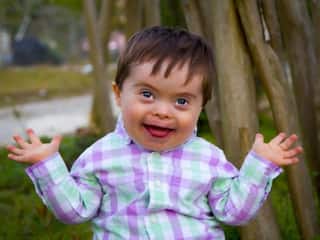 क्या होता है Down Syndrome? जानें इस बीमारी के कारण और लक्षण