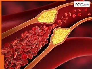 Bad Cholesterol को जड़ से खत्म कर देंगी ये 5 चीजें, बीमारियां रहेंगी कोसों दूर