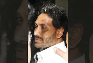 Andhra Pradesh CM Jagan Mohan Reddy Injured After Stone Hurled At Him In Vijayawada