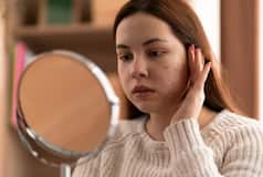 Acne Treatment: 8 Dietary Choices to Make to Get Clearer Skin