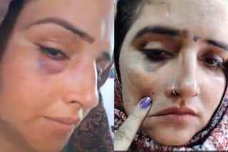 Pakistani 'Bhabhi' Seema Haider's Video Showing Injury Marks On Face Goes Viral: WATCH HERE