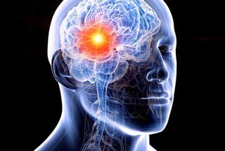 आम दिखने वाले ये लक्षण हो सकते हैं ब्रेन कैंसर के लक्षण, भूलकर भी ना करें इग्नोर