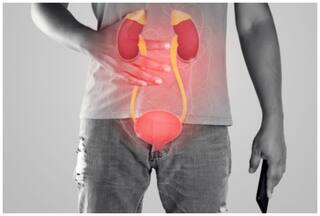 ब्लैडर कैंसर के खतरे को कई गुना बढ़ा सकता है धूम्रपान, इन बातों का रखें ध्यान