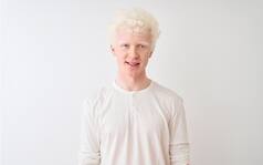 International Albinism Awareness Day 2024: Signs, Causes And Treatment of The Rare Genetic Condition