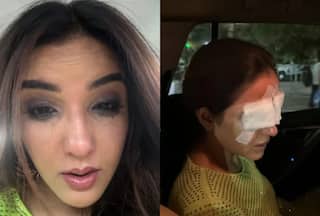 Jasmin Bhasin Reveals Lens Mishap Damaged Her Corneas, Says 'I am in a Lot of Pain'