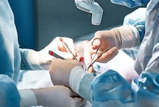 अब बिगड़े चेहरे को मिलेगी नई पहचान, AIIMS जल्द शुरू करेगा फेस ट्रांसप्लांट, जानिए कौन ले सकता लाभ