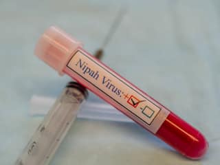 Kerala Nipah Virus Scare: Deceased Boy Came In Contact With Over 400 People; 194 Tagged High-Risk