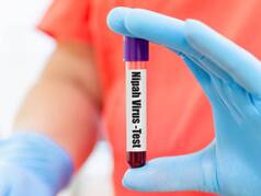 Kerala Nipah Virus Outbreak: Deceased Boy's Close Relatives Test Negative; 142 Healthcare Workers In Contact List Tagged 'High Risk'