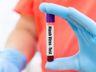 Kerala Nipah Virus Outbreak: Deceased Boy's Close Relatives Test Negative; 142 Healthcare Workers In Contact List Tagged 'High Risk'