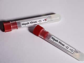 Kerala Nipah Virus Outbreak: 2 More On Deceased Boy's Contact List Test Negative; Nurse Booked For Violating Quarantine