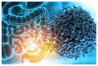आपकी आंतों के स्वास्थ्य से है आपकी त्वचा का सीधा संबंध