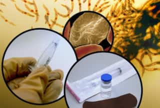 गर्भवती महिलाओं को मलेरिया से बचाने में कारगर हो सकता है एनआईएच का परीक्षणाधीन टीका