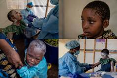 EXPLAINER: Will Mpox Trigger Another COVID Like Pandemic?