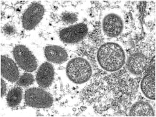 Mumbai On Alert: BMC Sets Up Special Ward Amid Monkeypox Scare