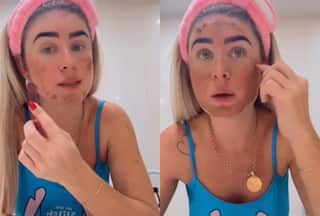 Bootyful Remedy! Influencer Uses Poop Face Mask To Prevent Aging; WATCH