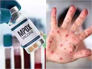Monkeypox Case: भारत में मिला मंकीपॉक्स का दूसरा मरीज, UAE से लौटा शख्स संक्रमित; जानें बचाव के उपाय