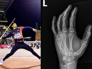 Diamond League 2024: नीरज चोपड़ा ने किया बड़ा खुलासा, टूटे हाथ के साथ खेला था फाइनल