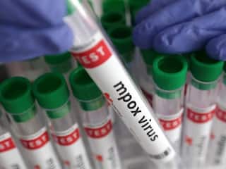Monkeypox in India: भारत में बढ़ा एमपॉक्स वारयस का खतरा! सामने आया पहला केस- केंद्र की गाइडलाइन जारी