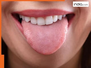 जीभ का सफेद होना दे सकता है इन गंभीर समस्याओं को न्योता, भूलकर भी न करें नजरअंदाज