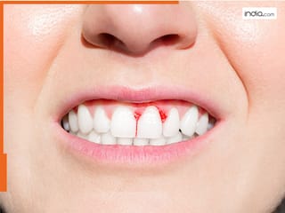 मसूड़ों से खून आना हो सकता है ब्लड कैंसर का इशारा, बिना देरी के इन गंभीर लक्षणों पर दें ध्यान